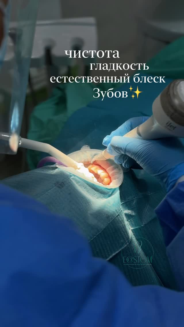 Профессиональная чистка